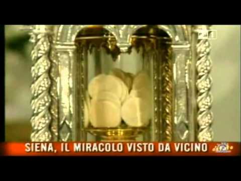 Quale decolorazione di crema aiuterà a liberarsi da lentiggini I posti di pigmentary si estendono su