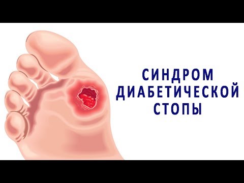 Удаление пигментных пятен с на энгельса Пигментация на коже вокруг соска