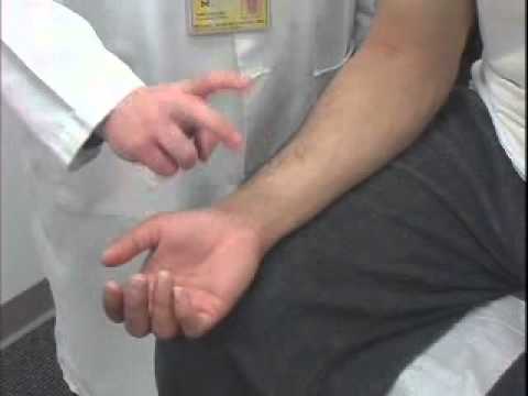 Tinel's Test of the Carpal Tunnel