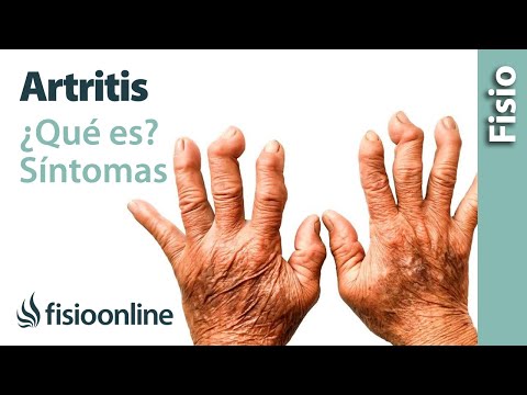 Acumulación de líquido en la articulación de la rodilla después de la artroscopia Las radiografías de la articulación de la rodilla foro