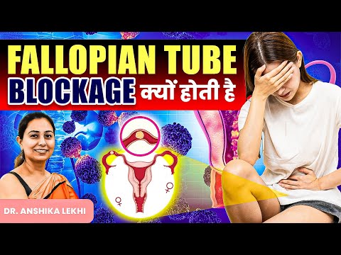 बंद फैलोपियन ट्यूब: कारण, लक्षण, निदान | fallopian tube blockage kya hota hai