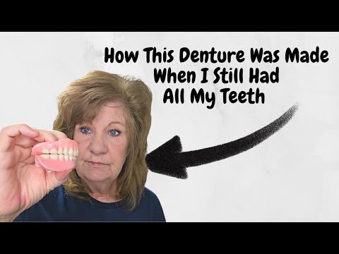 How An Immediate  Denture Is Made When You Still Have Teeth