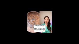 Download lagu Blackhead therapy mp3
