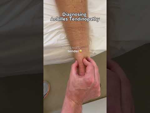 Diagnosing ACHILLES TENDINOPATHY in runners #running