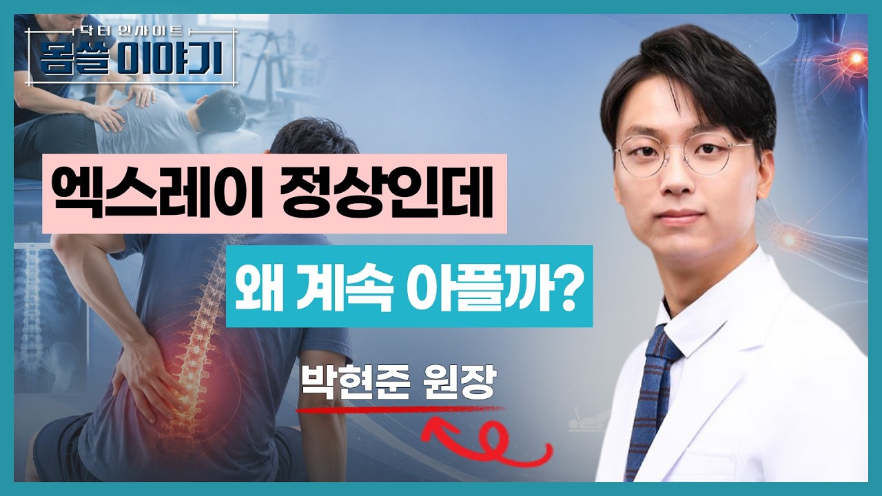 통증이 자꾸 재발한다면? 재활치료가 필요한 진짜 이유 [몸쓸이야기 26회]