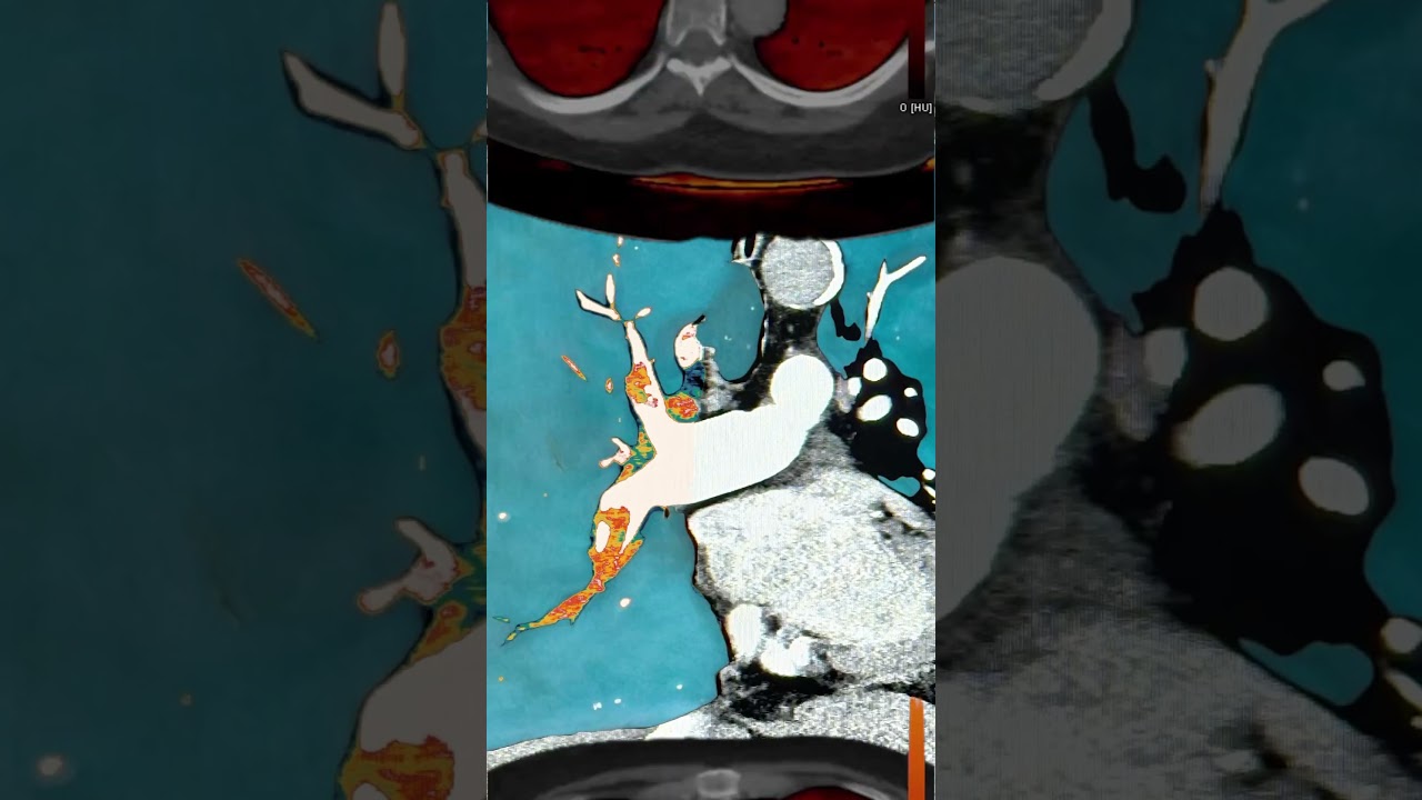 Edgar Alejandro Reyes García-23