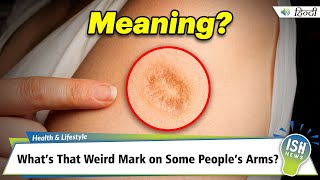 What’s That Weird Mark on Some People’s Arms?