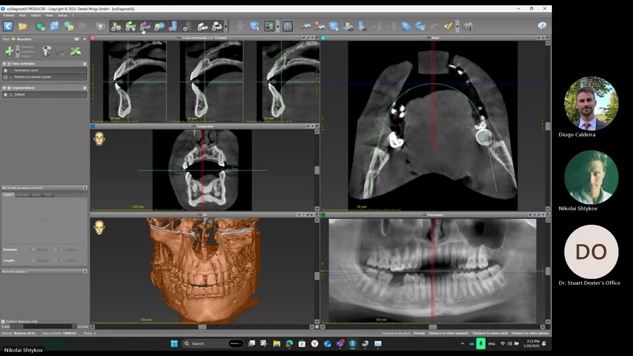 coDiagnostiX Basic Training Webinar eng