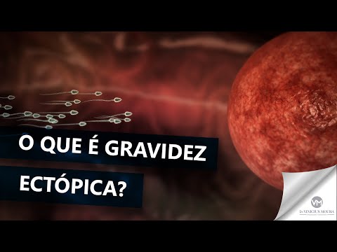 O que é gravidez ectópica?