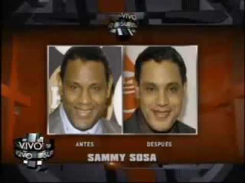 SuperXclusivo 11/12/09 - Mas negros que quieren ser blancos