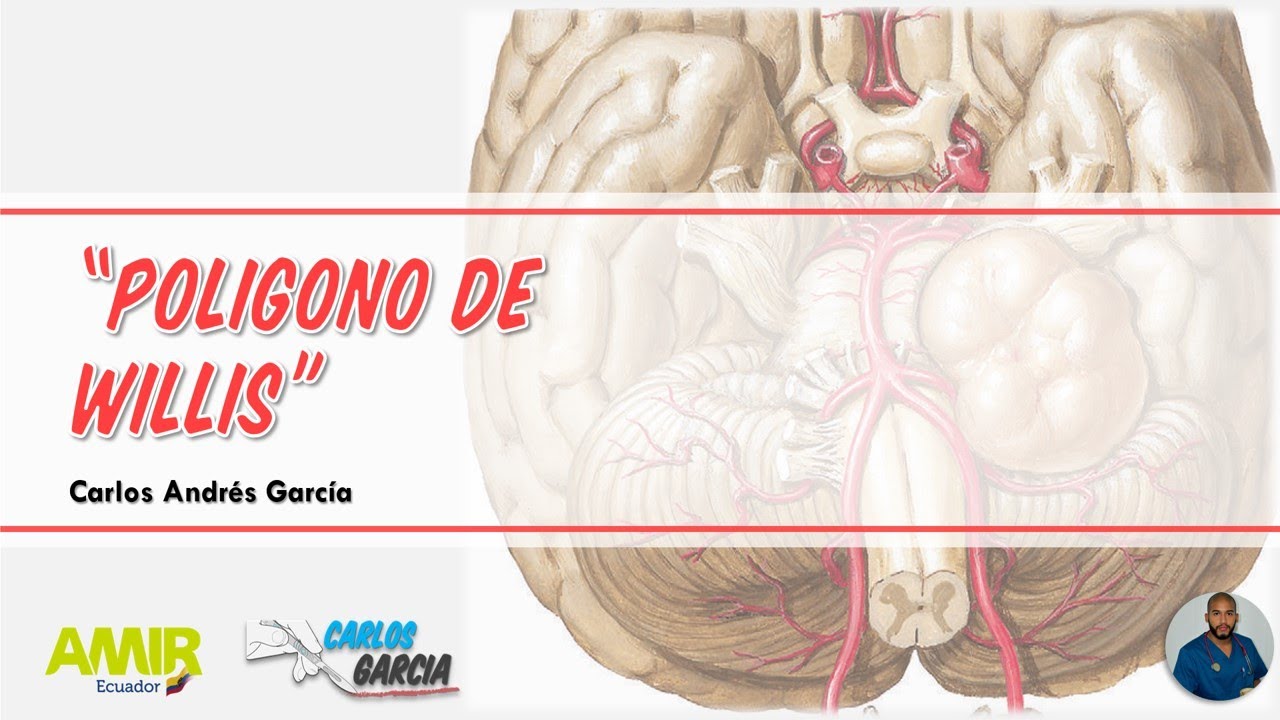 Anatomía - Poligono de Willis (Corformación y Ramas Centrales, Lenticuloestriadas)