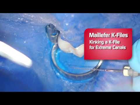 Dentsply NiTi Flex K Files - An Overview - DENTBEAR
