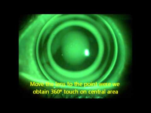 Fluorescein exam protocol DRL H