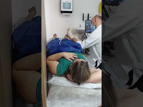 Aplicação de Ácido Hialurônico no Joelho - Artrose e Artrite com Dr. José Alexandre Cunha Baptista em Vitória ES