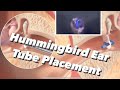 Ear Tube Placement with Hummingbird TTS from Preceptis Medical