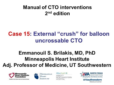 Case 15: Manual of CTO Interventions - External crush for balloon uncrossable CTO