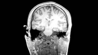 Download lagu Cutting Edge Biomedical Imaging | MRI Scan of a Person's Brain mp3