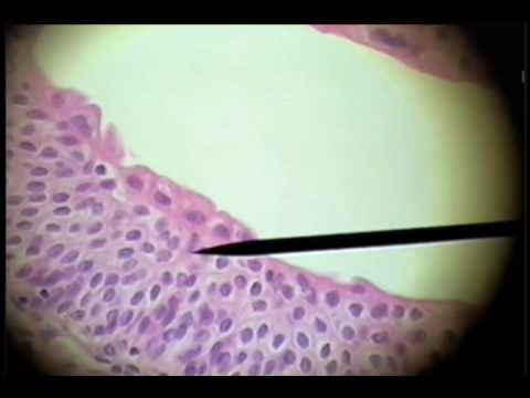 Slide 18 - Ureter - Transitional