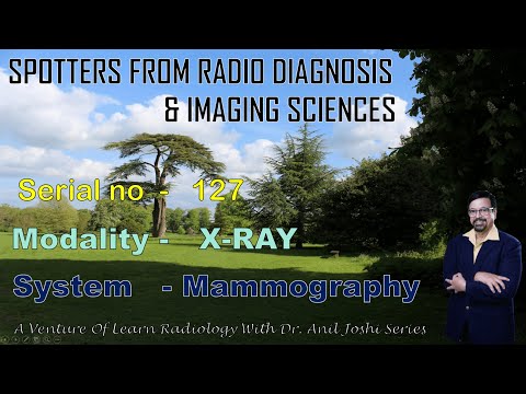 SPOTTERS FROM X-RAY MAMMOGRAPHY - 127 BY DR . ANIL JOSHI (PROFESSOR & HEAD OF RADIOLOGY DEPARTMENT).
