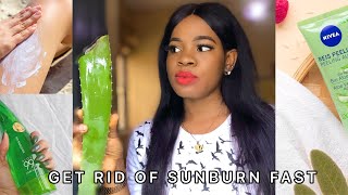 HOW TO GET RID OF SUNBURN FAST on the face | HOME REMEDIES + NATURAL REMEDIES