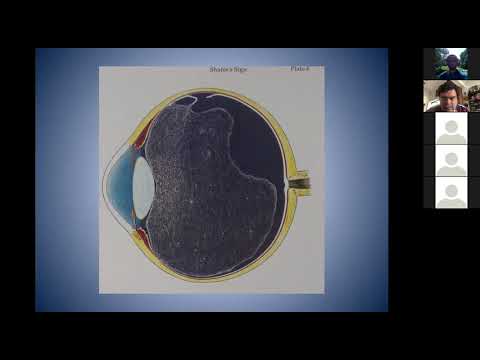 Cum să îmbunătățim viziunea asupra maculei Tratamentul retinopatiei diabetice și edemului macular