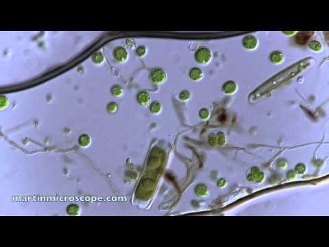 Pond Scum Under the Microscope
