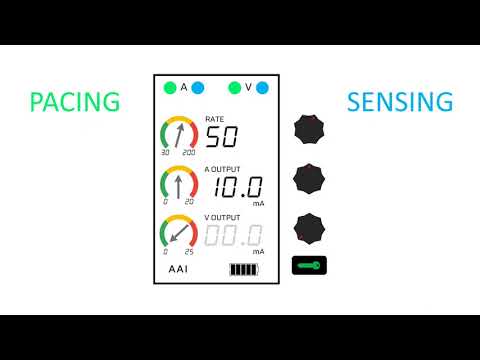 Temporary Epicardial Pacemakers and Sensitivity