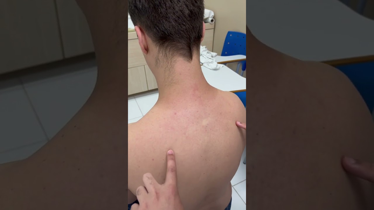 Expansibilidade do Tórax