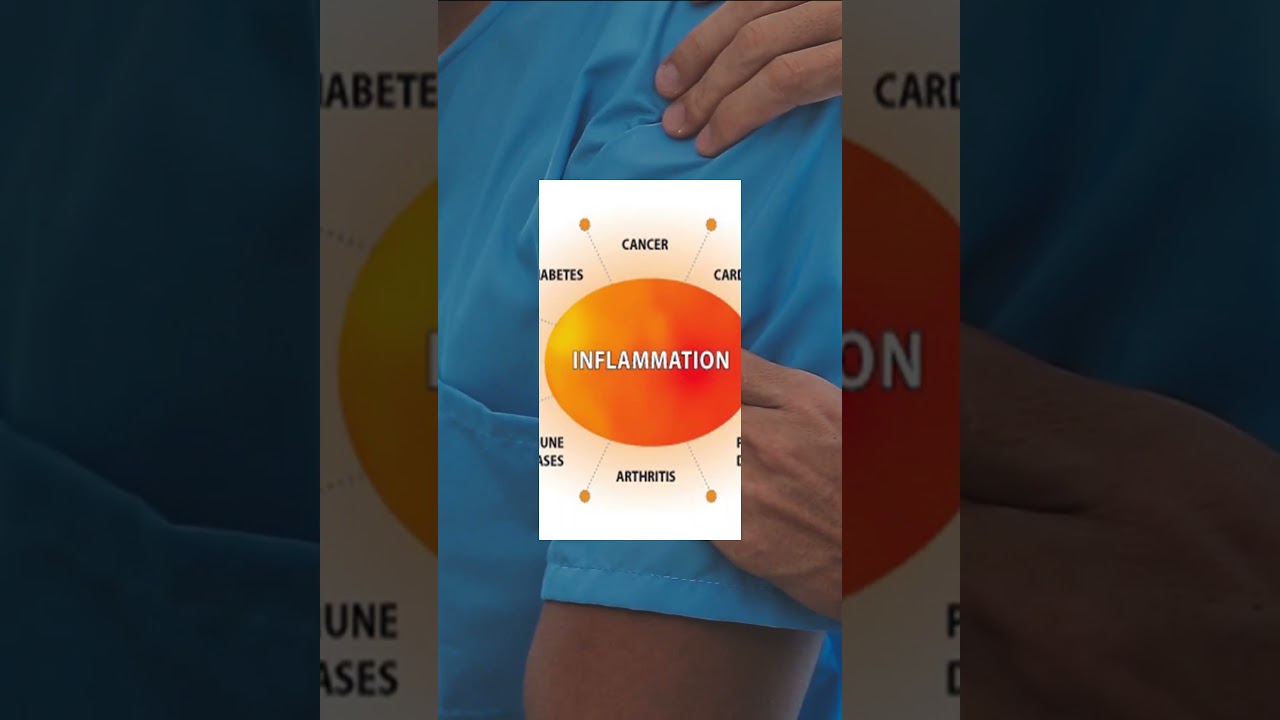 What is shoulder impingement? | Orthopedic Disease | Best Stem Cell Hospital In India | Stem Cell