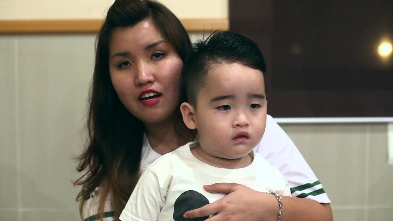 [Applesc] Lidia - Rambut rontok teratasi