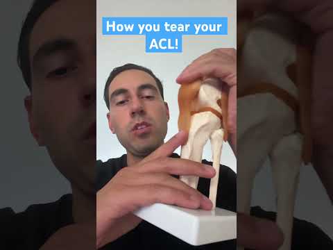 How you tear your acl ! #shorts #acltear