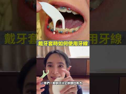 方形矯正線作用
