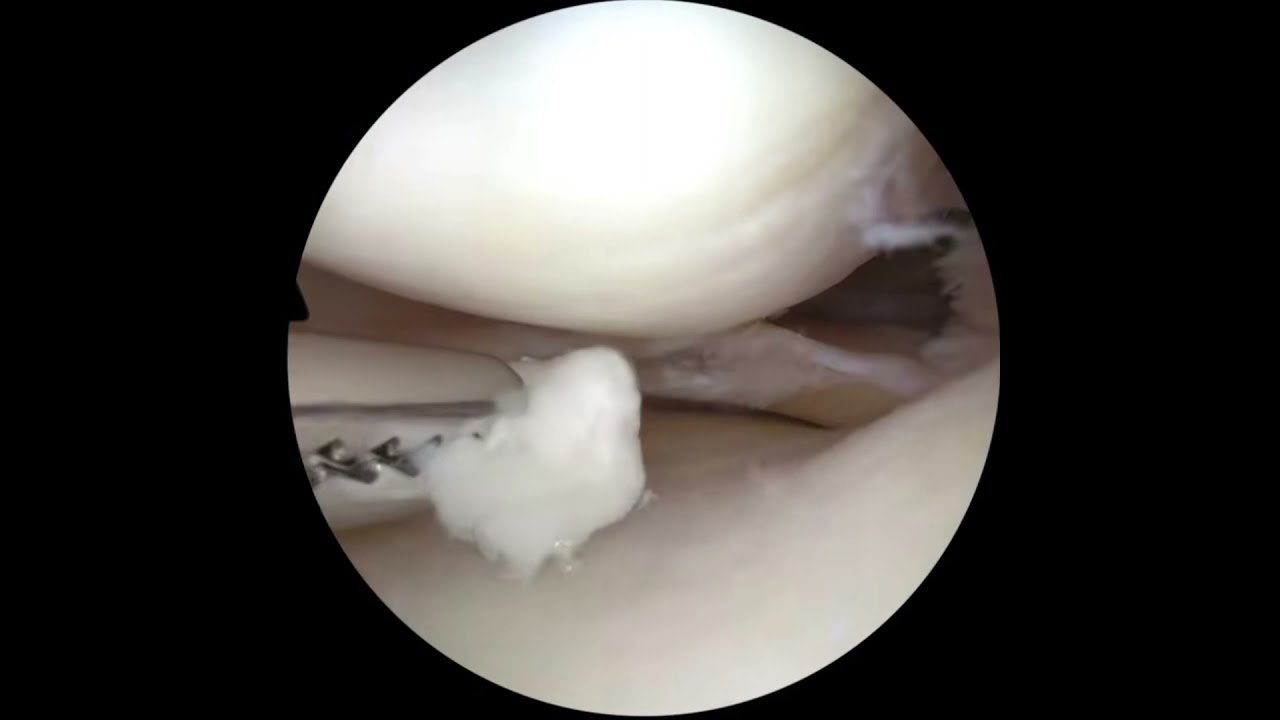 Carlos Angeles Negrete-28