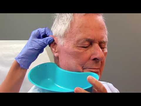 Instruct and Prepare a Patient for a Procedure of Treatment: Irrigate a Patient's Ear