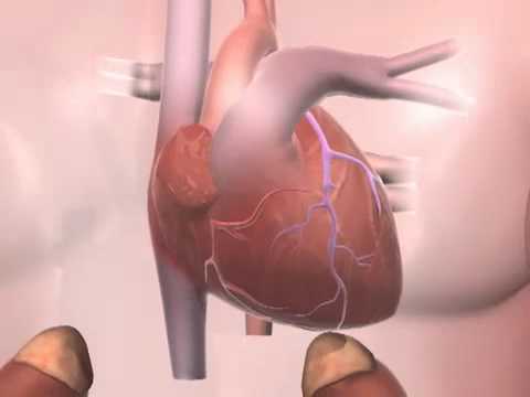 download lagu mp3 mp4 Forever Living Products To Treat High Blood Pressure, download lagu Forever Living Products To Treat High Blood Pressure gratis, unduh video klip Forever Living Products To Treat High Blood Pressure