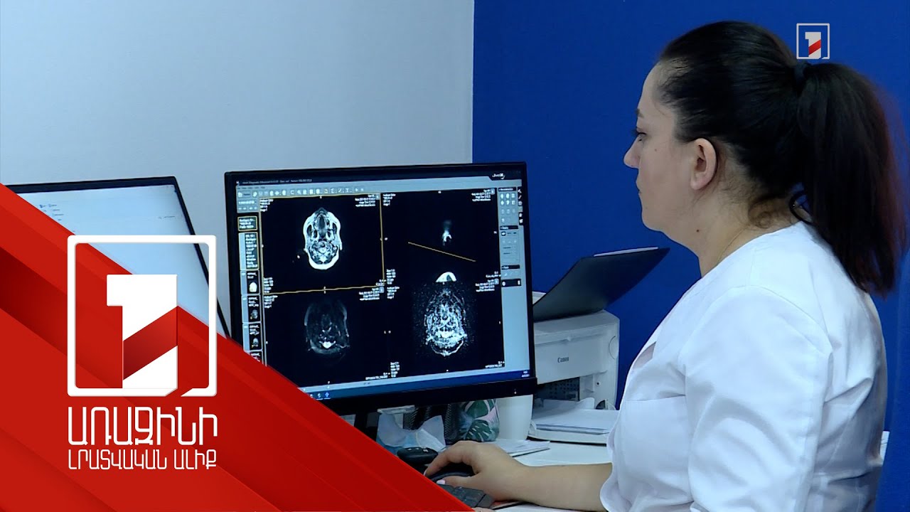 Անցում առողջապահության ֆինանսավորման նոր մոդելի․ քննարկվել է ապահովագրության հայեցակարգը