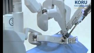 Ankara Robotik Cerrahi Sistemi - Koru Hastanesi +90-312-287-9797