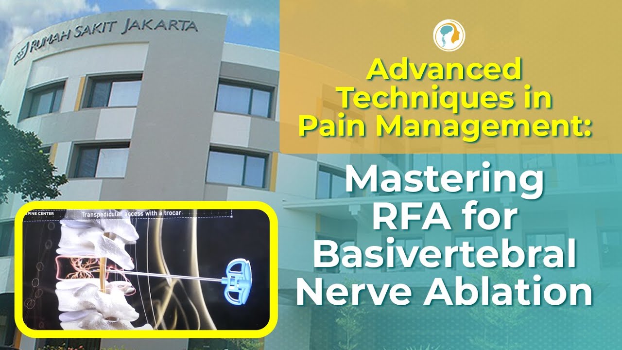 Advanced Techniques in Pain Management: Mastering RFA for Basivertebral Nerve Ablation