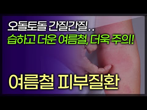 영상 썸네일