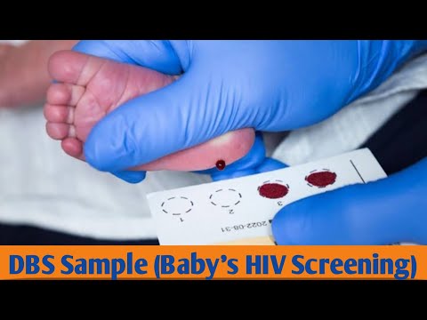 Thumbnail for DBS Sample | NewbornBaby's HIV Screening |Dried Blood Sample  Collection For PCR | by Nlood
