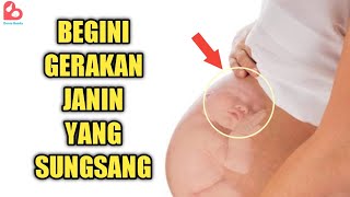 Download lagu Breech Fetal Movements That Pregnant Women Can Feel mp3 Download lagu Breech Fetal Movements That Pregnant Women Can Feel mp3