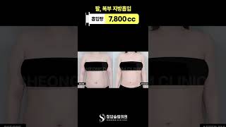 상체차이.. 이게 같은사람 맞아..?