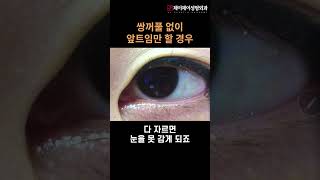 앞트임 성형 시술