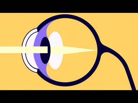 How the eyes work - Lesson 6, Unit 6.1 Light & Matter