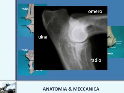 Pomata dal dolore della malattia degenerativa del disco cervicale Giunti meccanici 6 lettere