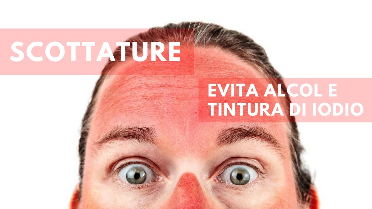 Watch Now Scottature | Pronto Soccorso Naturale Scottature | Pronto Soccorso Naturale