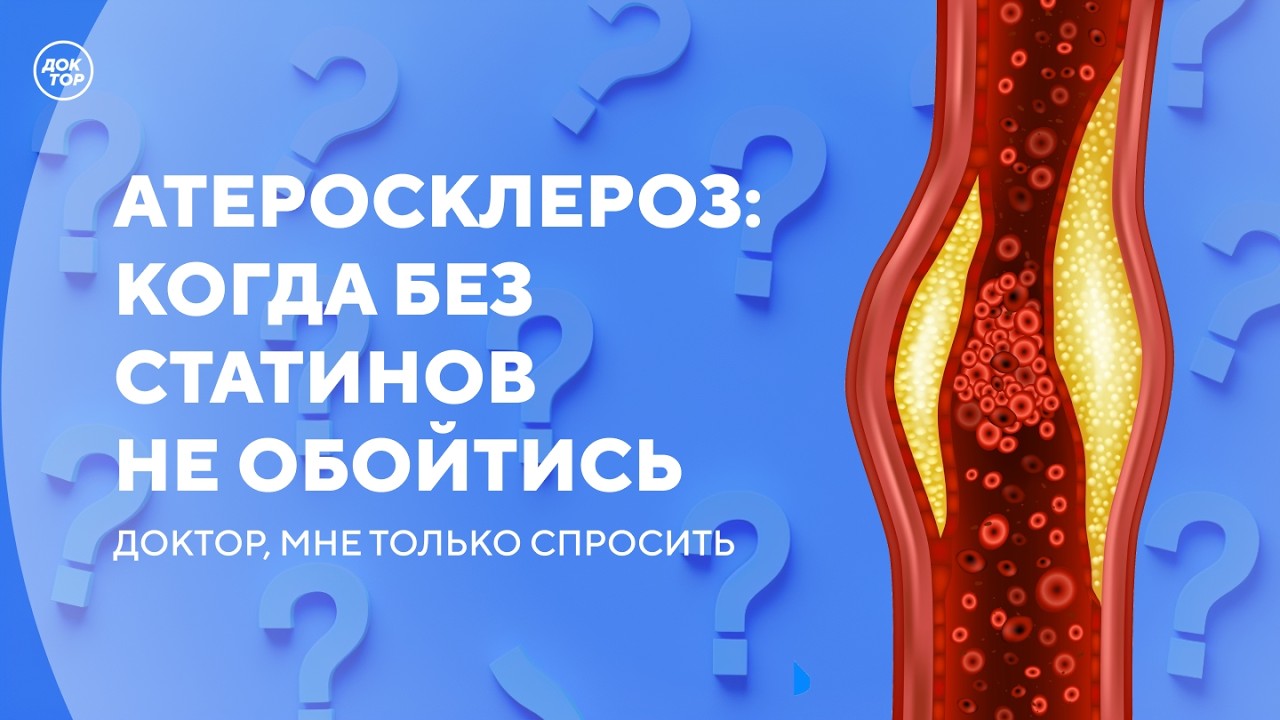 Что нужно знать о статинах при атеросклерозе/ Доктор, мне только спросить