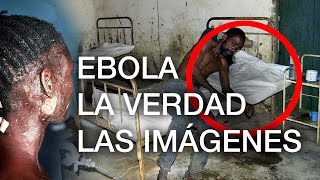 La enfermedad del miedo IMPACTANTES imágenes sobre el Ebola - no apto para sensibles