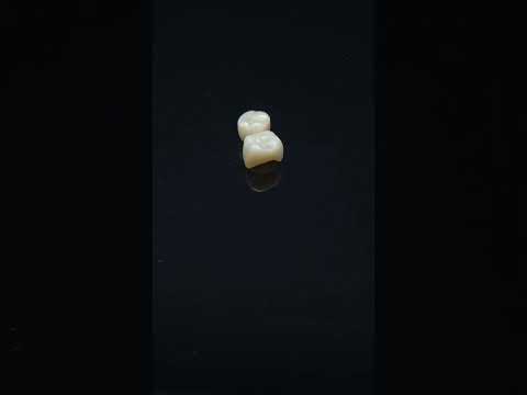 YouTube 썸네일
