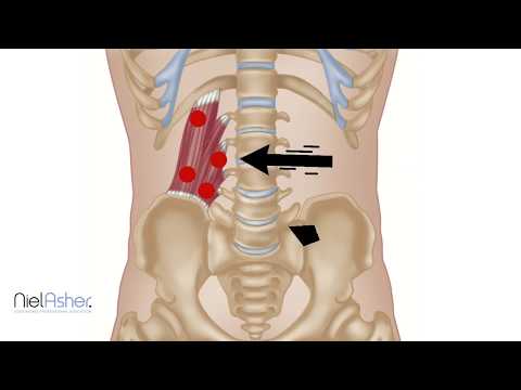 Quadratus Lumborum (QL) Trigger Points Explained | Causes, Symptoms, and Pain Relief
